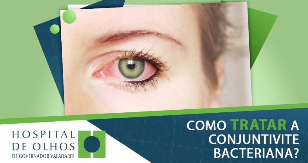 Como tratar a conjuntivite bacteriana? - Hospital de Olhos de ...